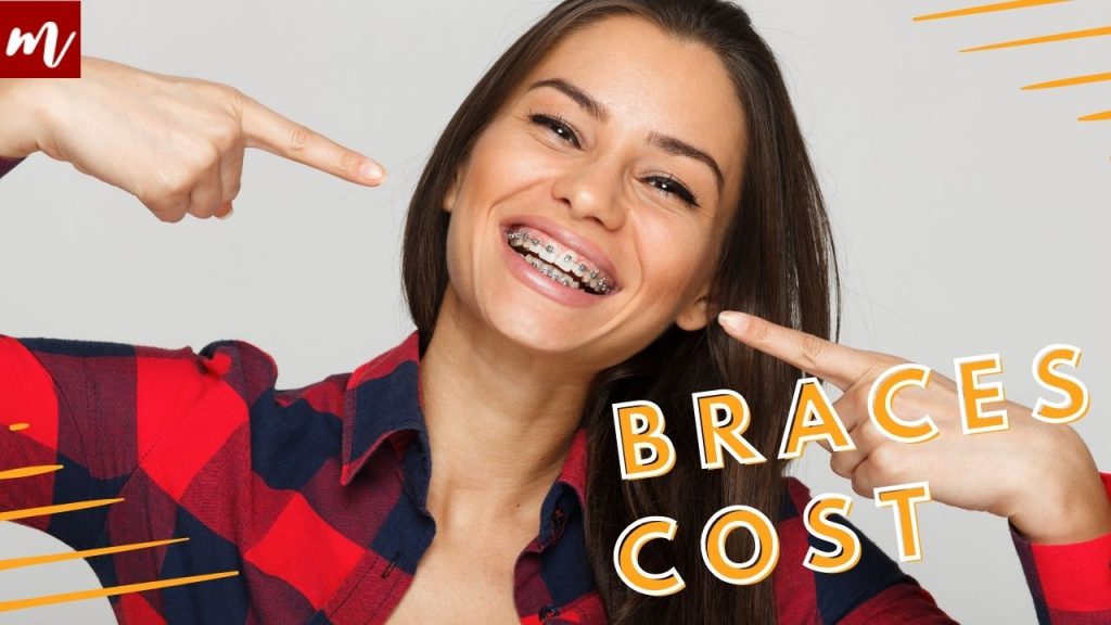 how much do braces cost