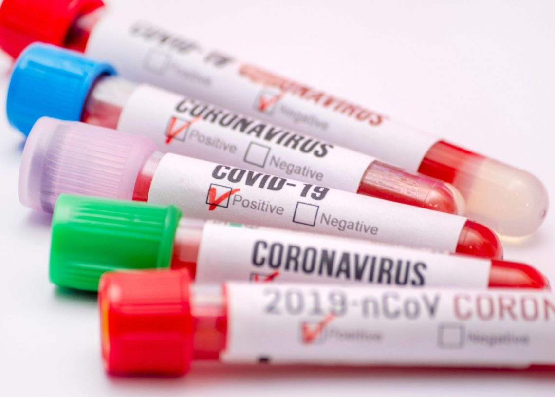 Vietnam Opts for Mass Testing After the Emergence of a New Covid Variant