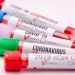 Vietnam Opts for Mass Testing After the Emergence of a New Covid Variant
