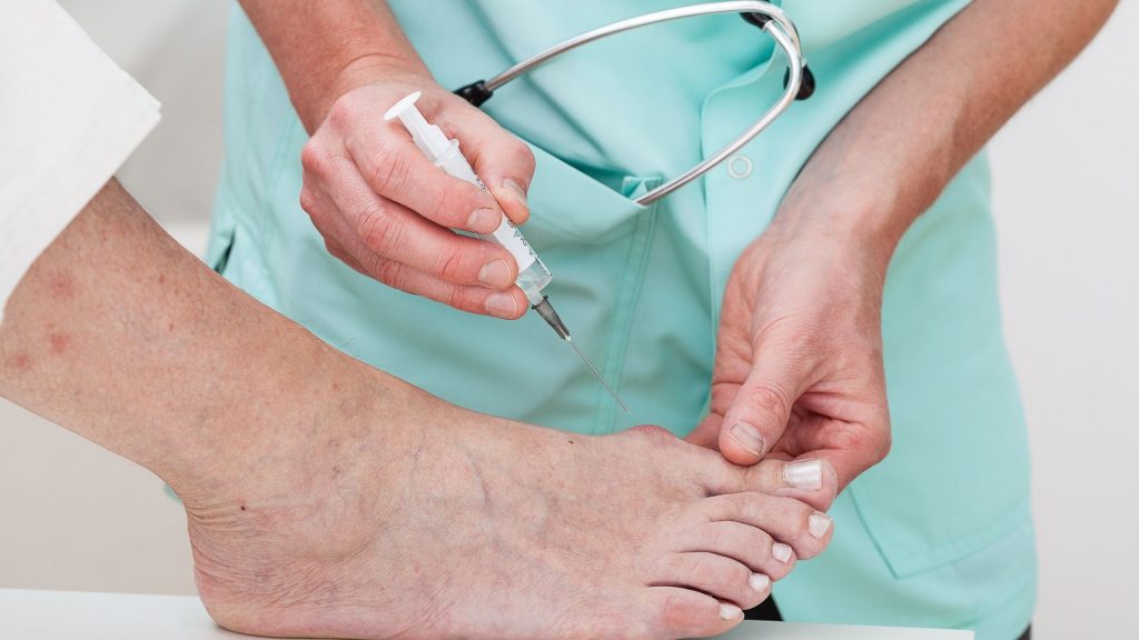A doctor injecting medicine to give toe bunion relief to a patient